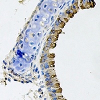 WNT5B Rabbit Polyclonal Antibody