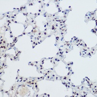 ZNF145 Rabbit Polyclonal Antibody