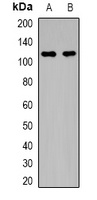 MYPT1 (Phospho-T696) Rabbit Polyclonal Antibody