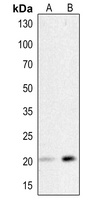 HSP20 (Phospho-S16) Rabbit Polyclonal Antibody
