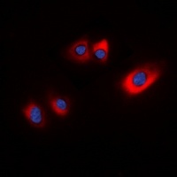 HSP20 (Phospho-S16) Rabbit Polyclonal Antibody