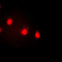 Cyclin E1 (Phospho-T77) Rabbit Polyclonal Antibody