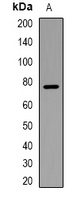 DDX3X (Phospho-T322) Rabbit Polyclonal Antibody