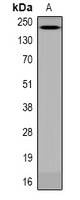 ANAPC1 (Phospho-S688) Rabbit Polyclonal Antibody