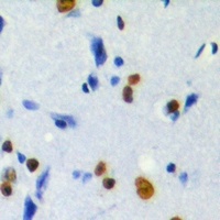 MKI67IP (Phospho-T234) Rabbit Polyclonal Antibody