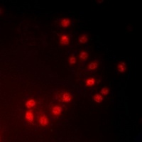 MKI67IP (Phospho-T234) Rabbit Polyclonal Antibody