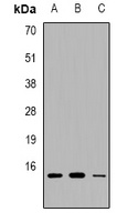 PEA15 Rabbit Polyclonal Antibody