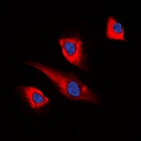 PEA15 Rabbit Polyclonal Antibody