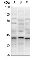 XRCC3 Rabbit Polyclonal Antibody