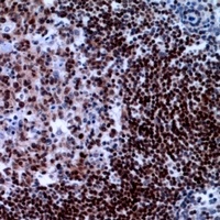 XRCC3 Rabbit Polyclonal Antibody