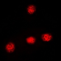 XRCC3 Rabbit Polyclonal Antibody
