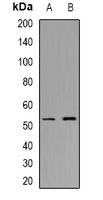 CHST9 Rabbit Polyclonal Antibody