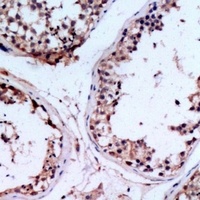 CHST9 Rabbit Polyclonal Antibody