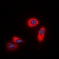 CHST9 Rabbit Polyclonal Antibody