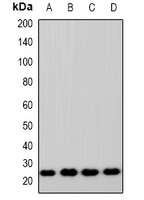 ZNRF2 Rabbit Polyclonal Antibody
