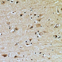 ZNRF2 Rabbit Polyclonal Antibody