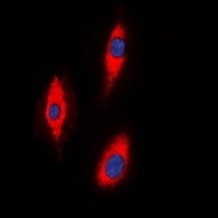 ZNRF2 Rabbit Polyclonal Antibody
