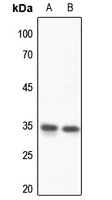HOXD13 Rabbit Polyclonal Antibody