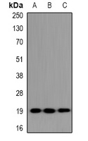 UBE2G1 Rabbit Polyclonal Antibody