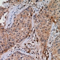 UBE2G1 Rabbit Polyclonal Antibody