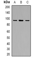 USP6NL Rabbit Polyclonal Antibody