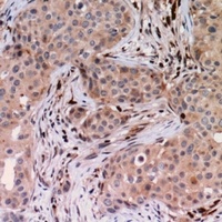 USP6NL Rabbit Polyclonal Antibody