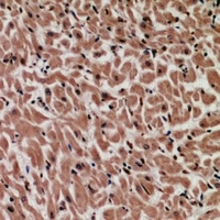 MYCBP Rabbit Polyclonal Antibody