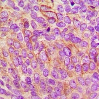 CD85c Rabbit Polyclonal Antibody