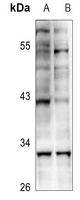 KLF13 (Acetyl-K166) Rabbit Polyclonal Antibody