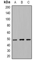 Beta-tubulin (Acetyl-K379) Rabbit Polyclonal Antibody
