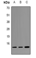 Alpha-synuclein (Phospho-Y125) Rabbit Polyclonal Antibody