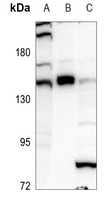 GLI1 Rabbit Polyclonal Antibody