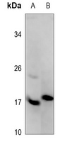 ASF1A Rabbit Polyclonal Antibody