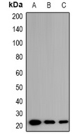 EID1 Rabbit Polyclonal Antibody