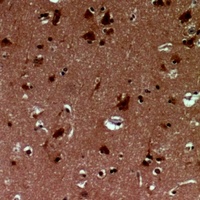 EID1 Rabbit Polyclonal Antibody