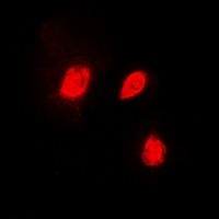 EID1 Rabbit Polyclonal Antibody