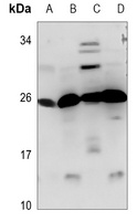 CIDEB Rabbit Polyclonal Antibody