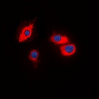 CIDEB Rabbit Polyclonal Antibody
