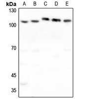 FUK Rabbit Polyclonal Antibody