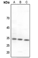 CNOT7 Rabbit Polyclonal Antibody