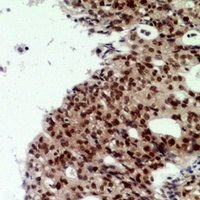 CNOT7 Rabbit Polyclonal Antibody