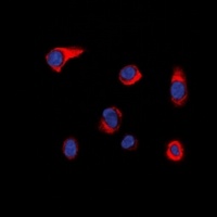 PIP5K Rabbit Polyclonal Antibody