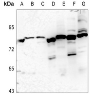 EPS8L1 Rabbit Polyclonal Antibody