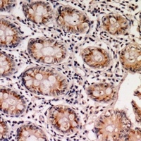 EPS8L1 Rabbit Polyclonal Antibody