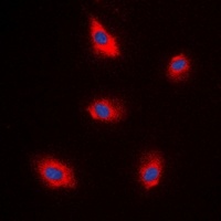 EPS8L1 Rabbit Polyclonal Antibody