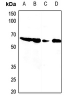 PDCD12 Rabbit Polyclonal Antibody