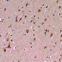 PDCD12 Rabbit Polyclonal Antibody