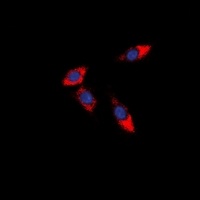 PDCD12 Rabbit Polyclonal Antibody