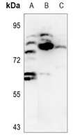 DCLK2 Rabbit Polyclonal Antibody