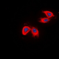 DCLK2 Rabbit Polyclonal Antibody
